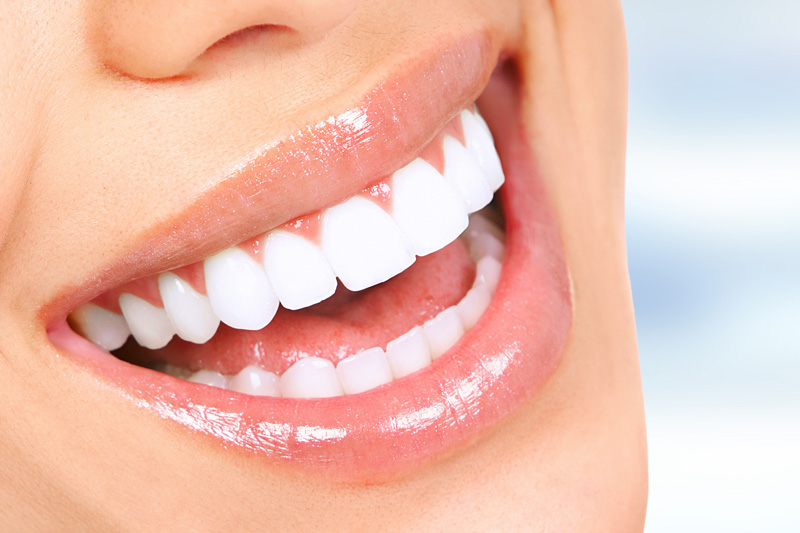 Cosmetic Dentistry in Beverly Hills
