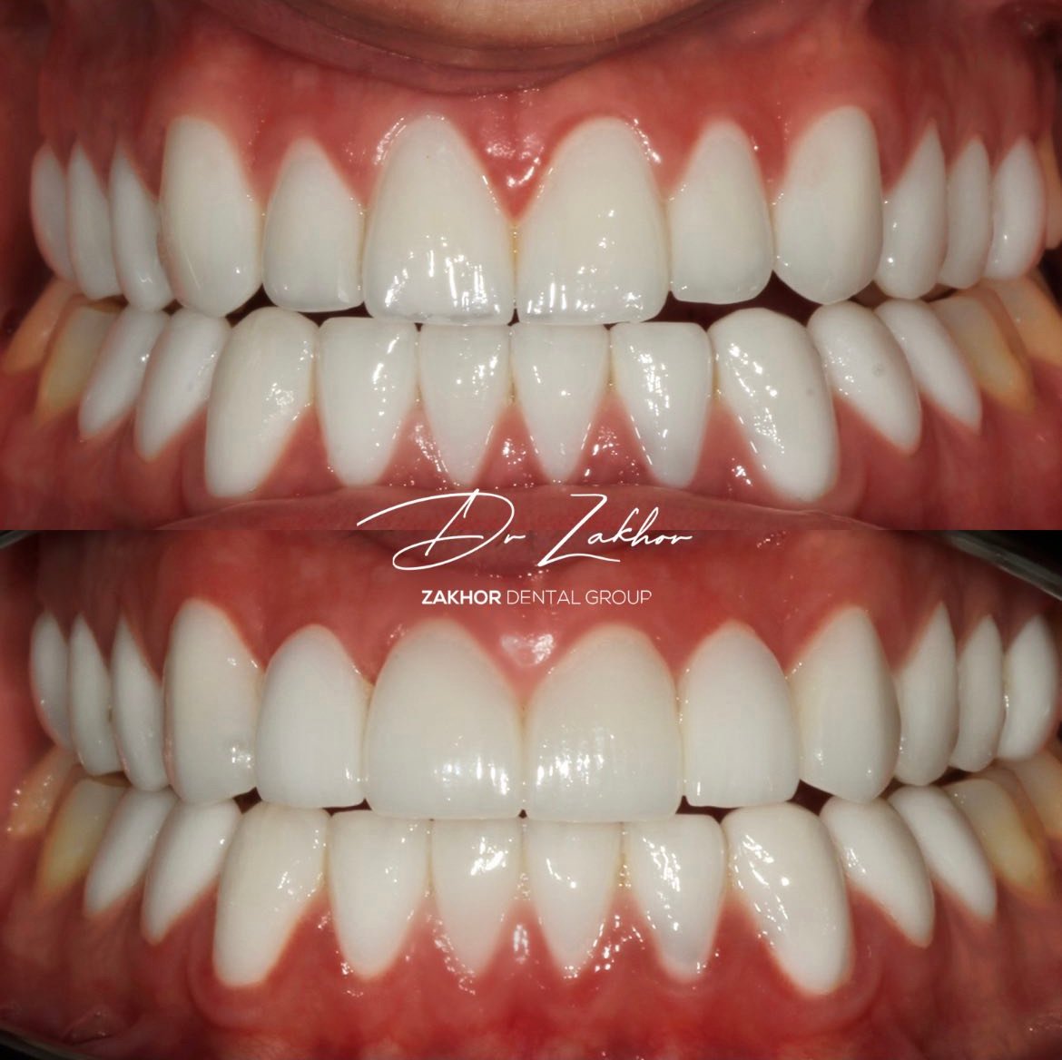 los-angeles-biomimetic-dentistry
