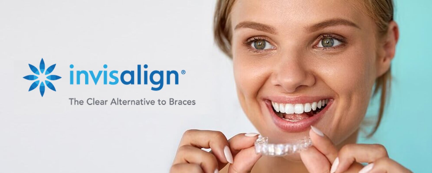 Invisalign