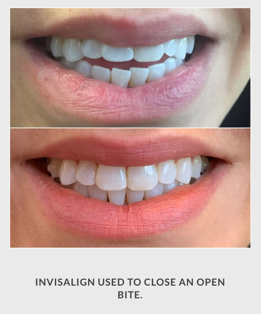 Before — dental case