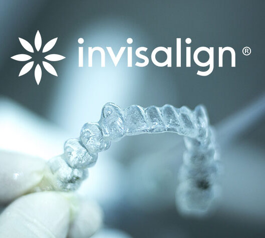 invisalig