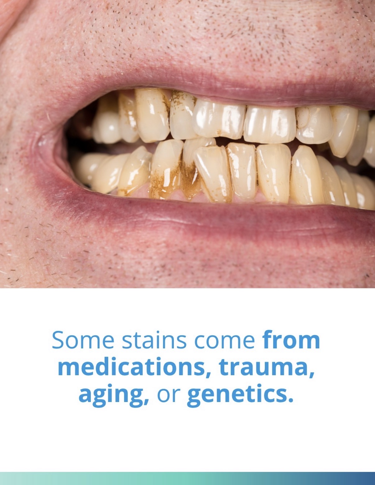 KöR whitening consultation