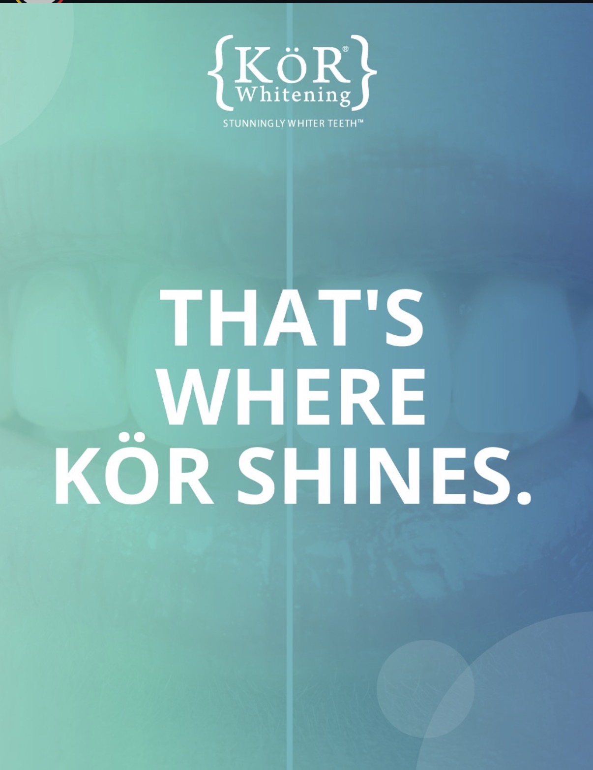 KöR whitening final result